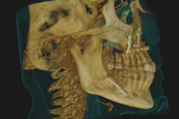 manuel ruiz radiologia 3d 01