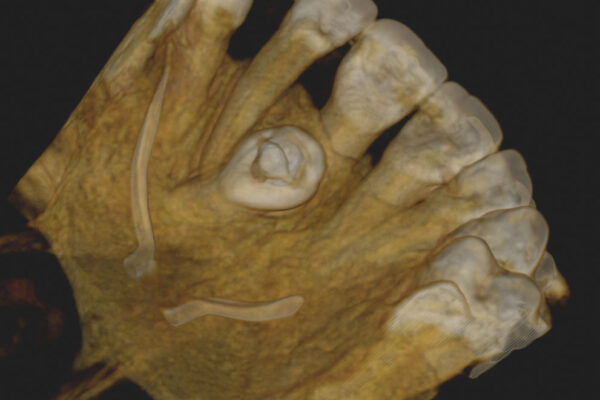 manuel ruiz radiologia 3d 20
