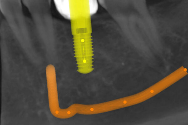 manuel ruiz radiologia 3d 25