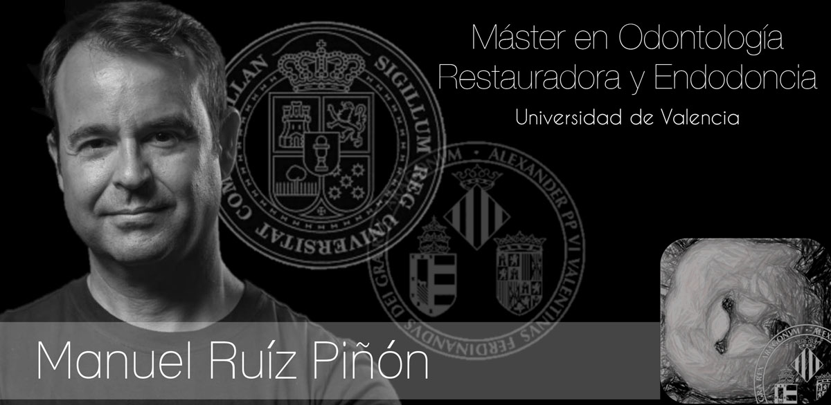 Master en Odontología Restauradora y Endodoncia Universidad de Valencia